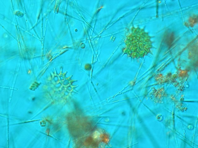 fytoplanktonnovozmeckhorybnka.jpg