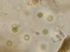 asterococcussuperbus_small.jpg