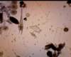 phytoplanktonflorawithceratiumfurcadinophysiscaudataoxytoxumsp_small.jpg