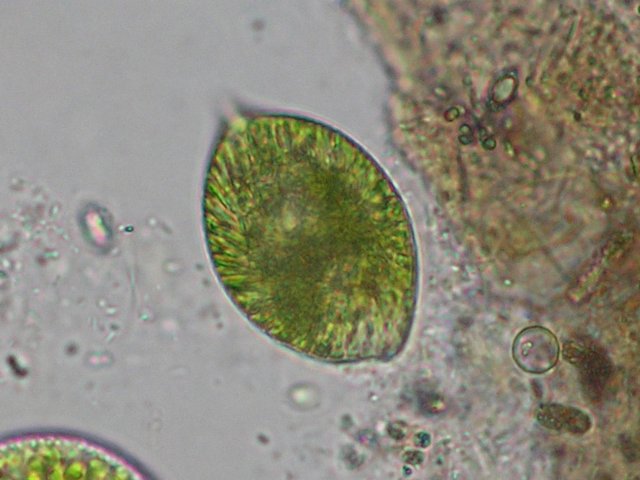 euglenasplendensasteroidnchloroplast.jpg