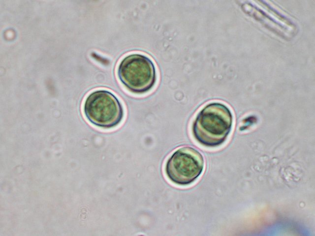 chroococcusspzemplnskrava.jpg